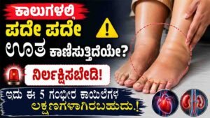 ಕಾಲುಗಳಲ್ಲಿ ಪದೇ ಪದೇ ಊತ ಕಾಣಿಸುತ್ತಿದೆಯೇ?