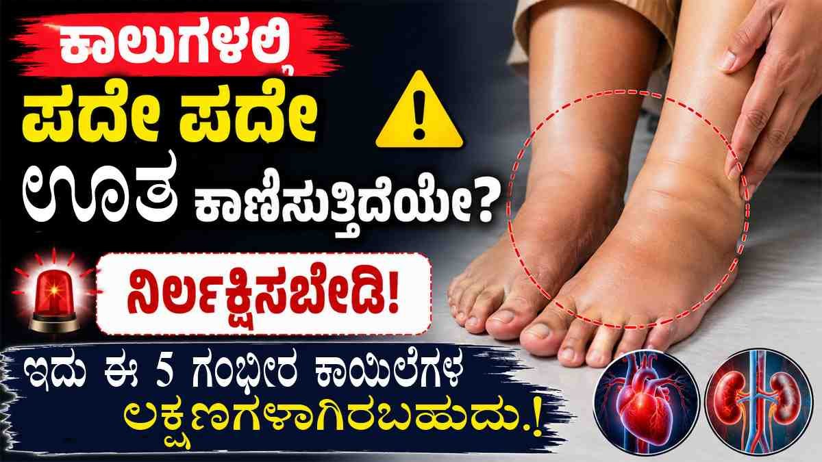 ಕಾಲುಗಳಲ್ಲಿ ಪದೇ ಪದೇ ಊತ ಕಾಣಿಸುತ್ತಿದೆಯೇ?