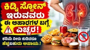 ಕಿಡ್ನಿ ಸ್ಟೋನ್
