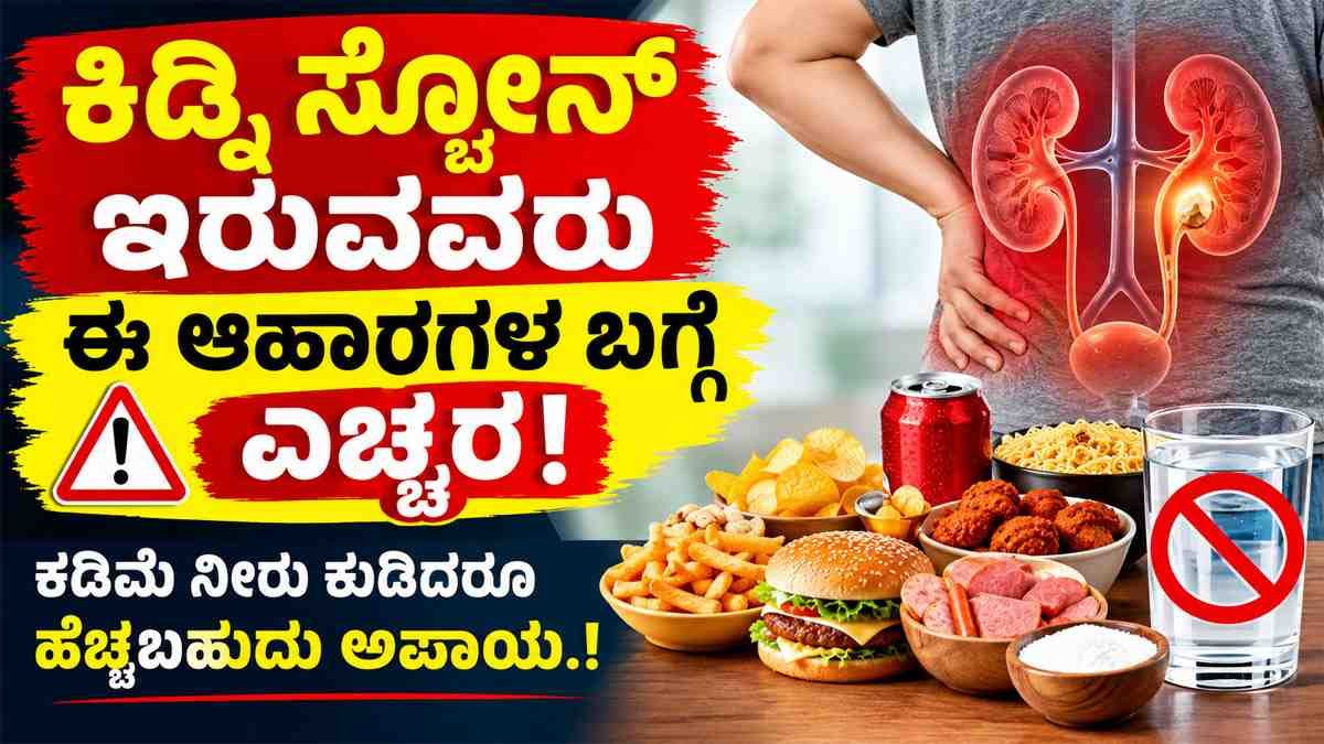 ಕಿಡ್ನಿ ಸ್ಟೋನ್